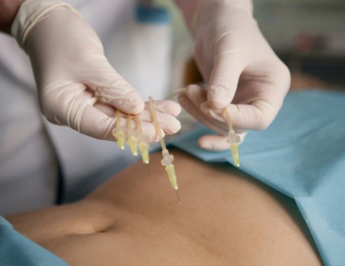 Озонотерапия - Санаторий «Здоровье» Железноводск